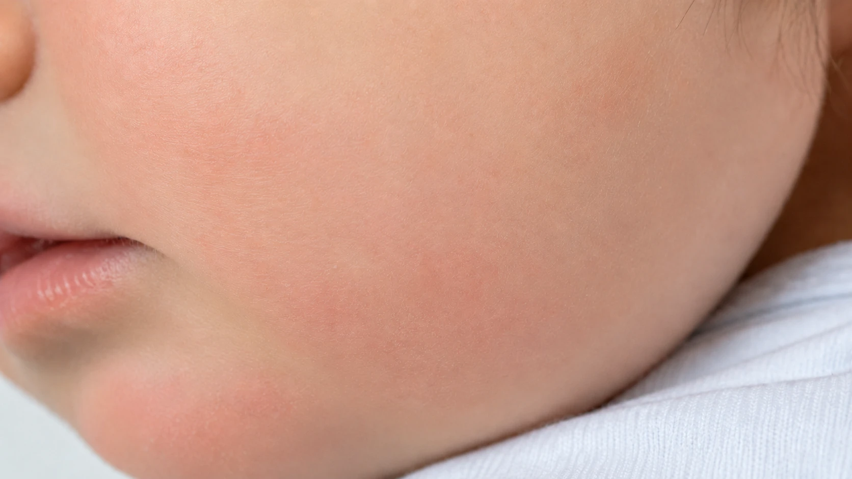 After 2 weeks: skin calmed and redness reduced