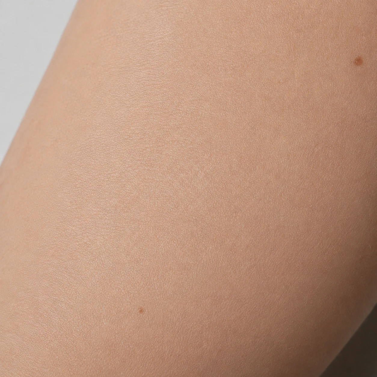 After — calmer, smoother skin
