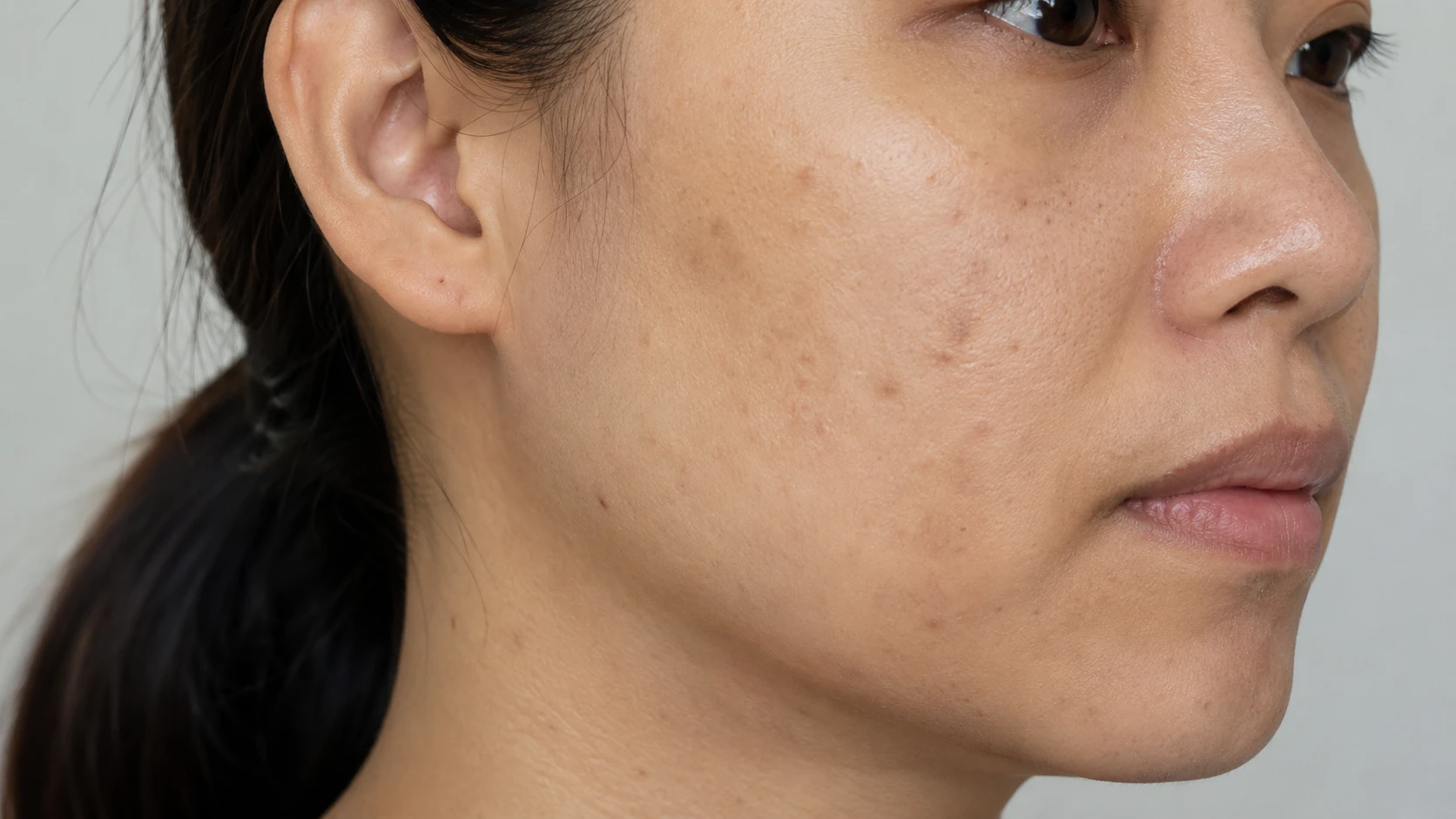 Before: dull blemish-prone face skin