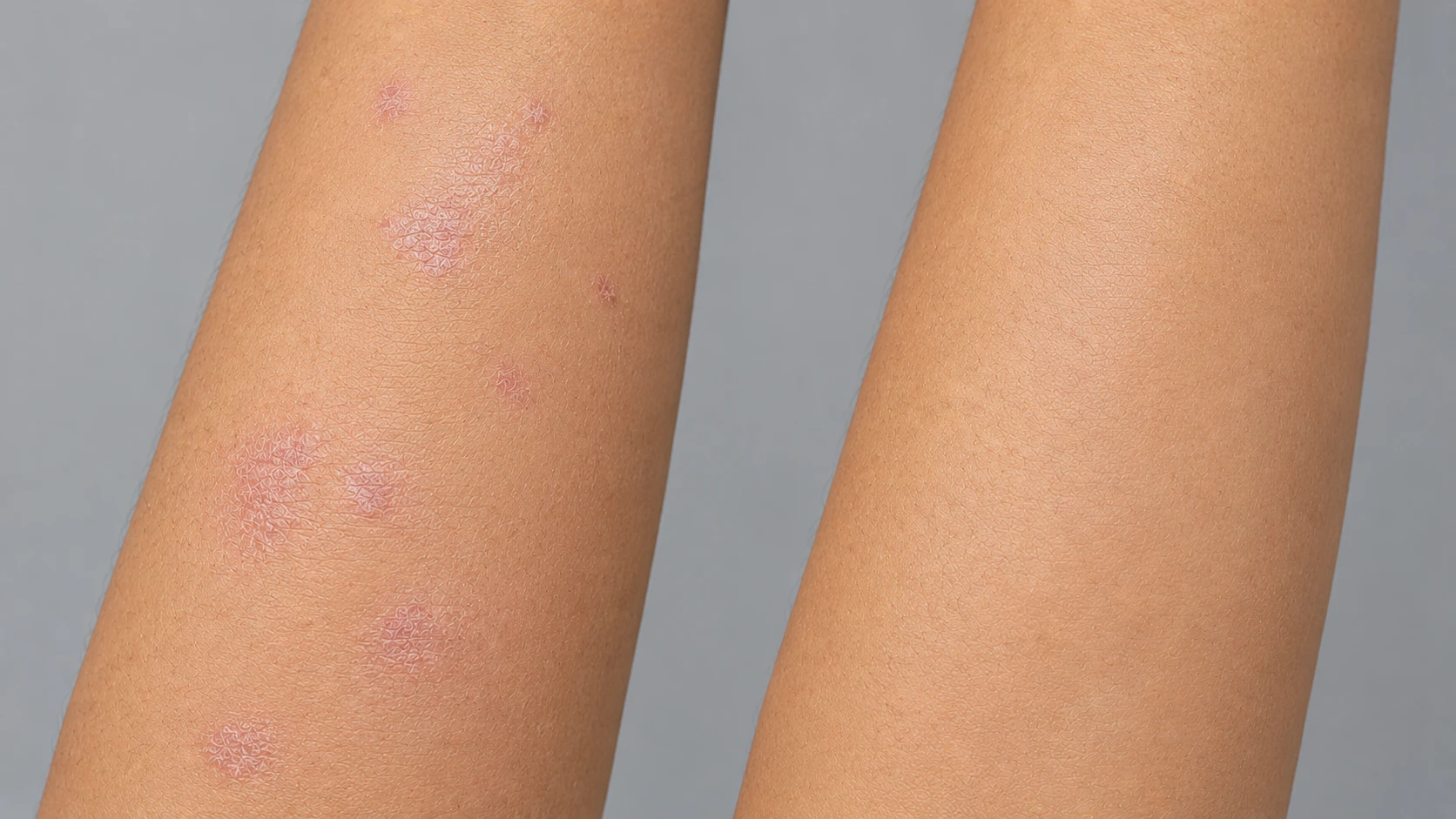 Arm: before and after