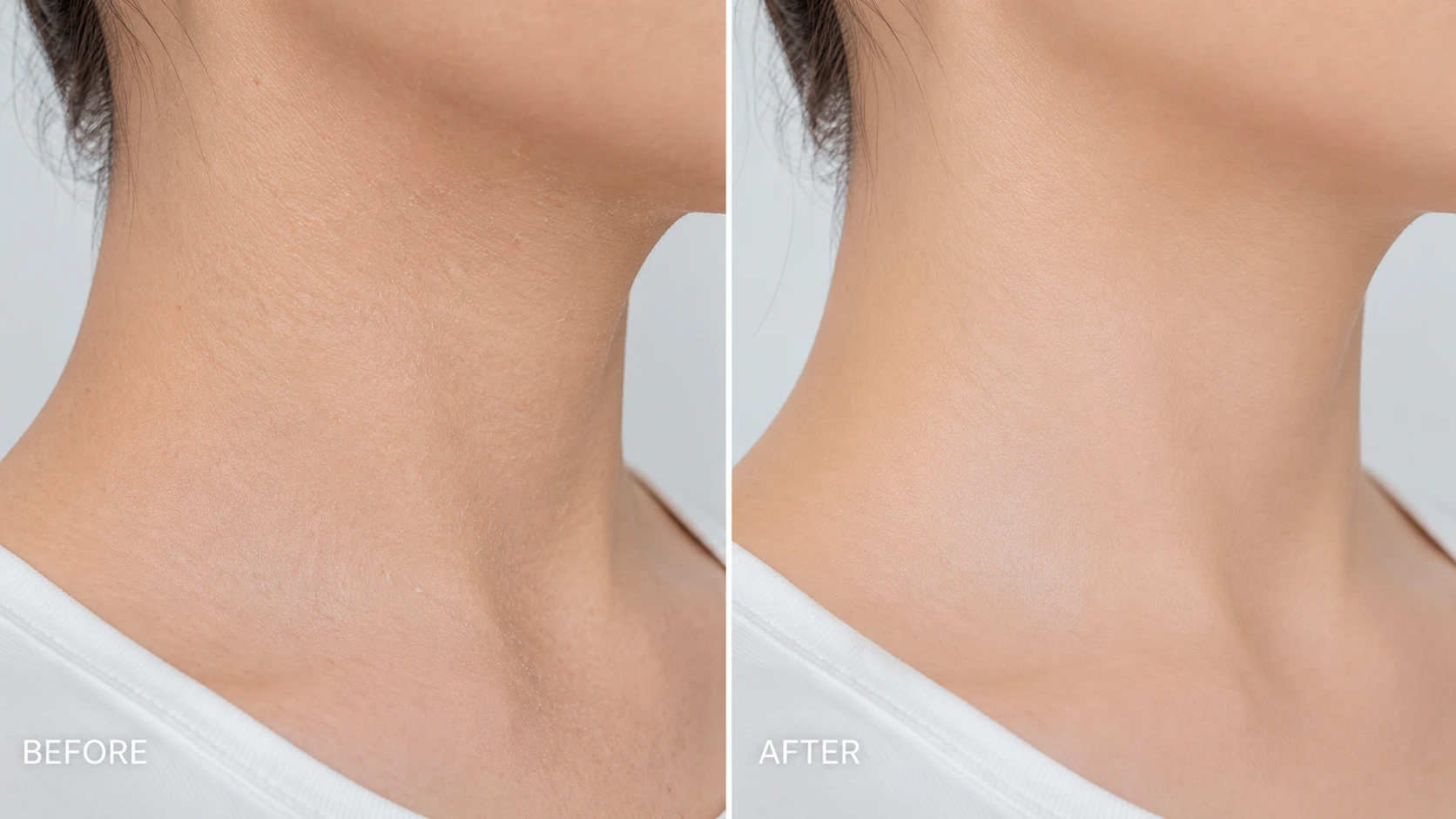 Neck: before and after