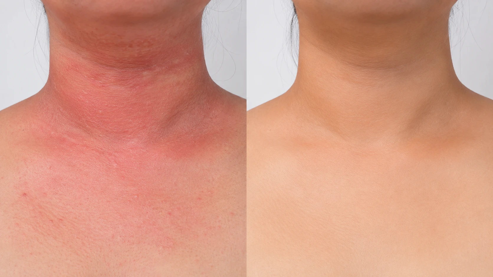 Neck: before and after