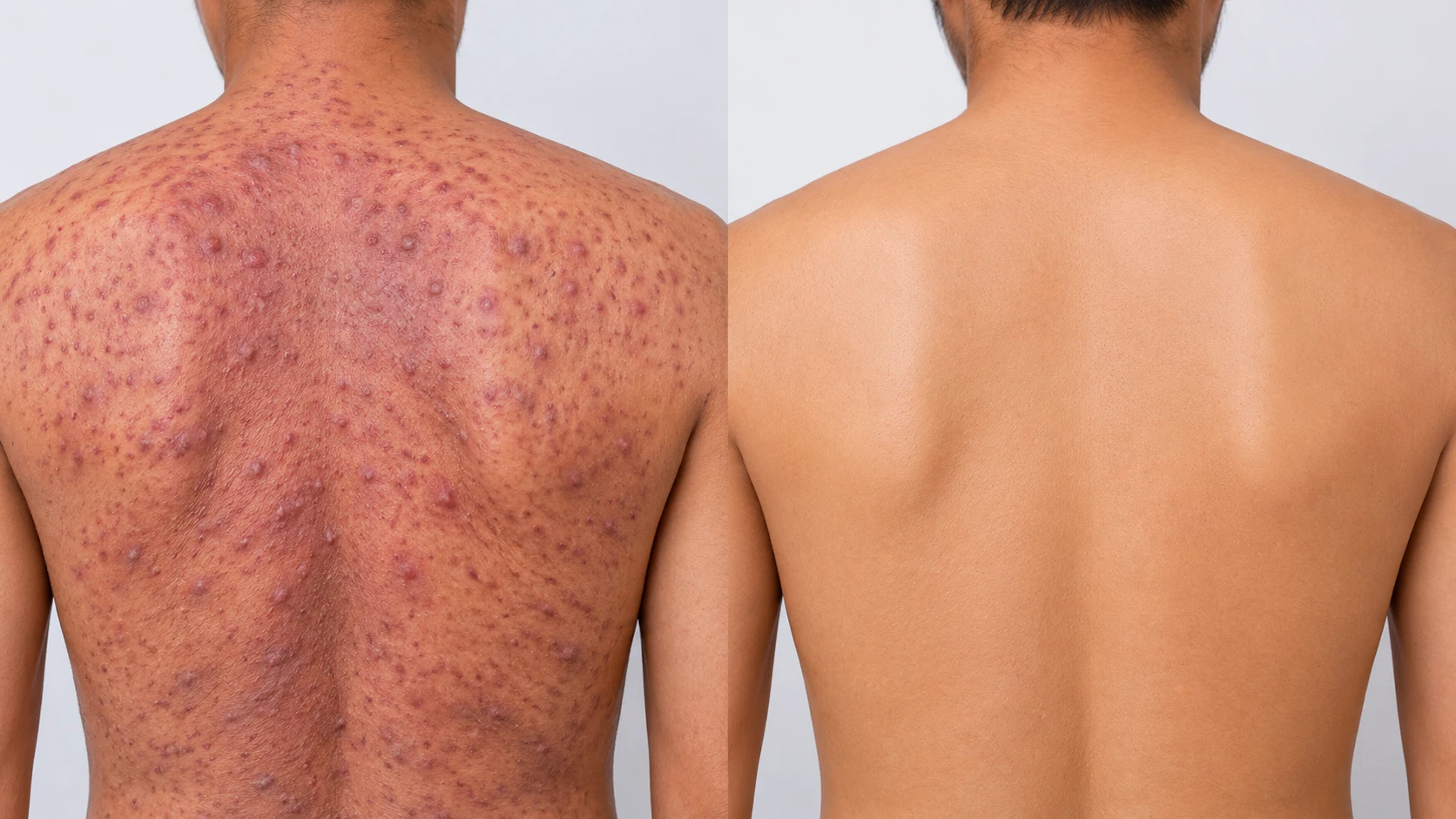 Back: before and after