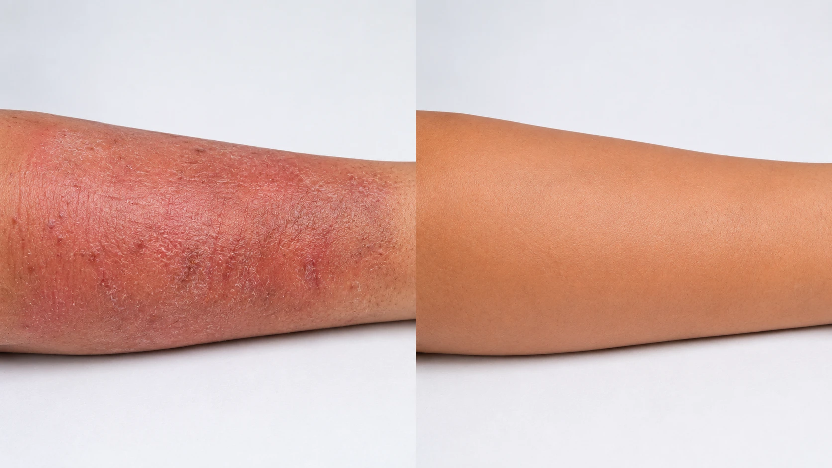 Hand: before and after